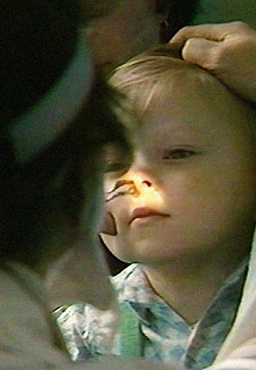 Чорнобильська трагедія: дитячі хвороби 