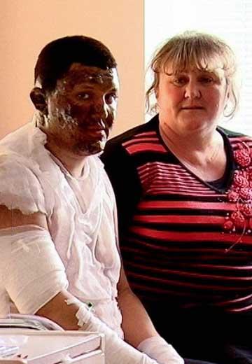 Mine accident: treatment of miners