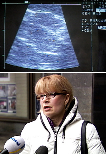Breast Cancer: Treatment Issues
